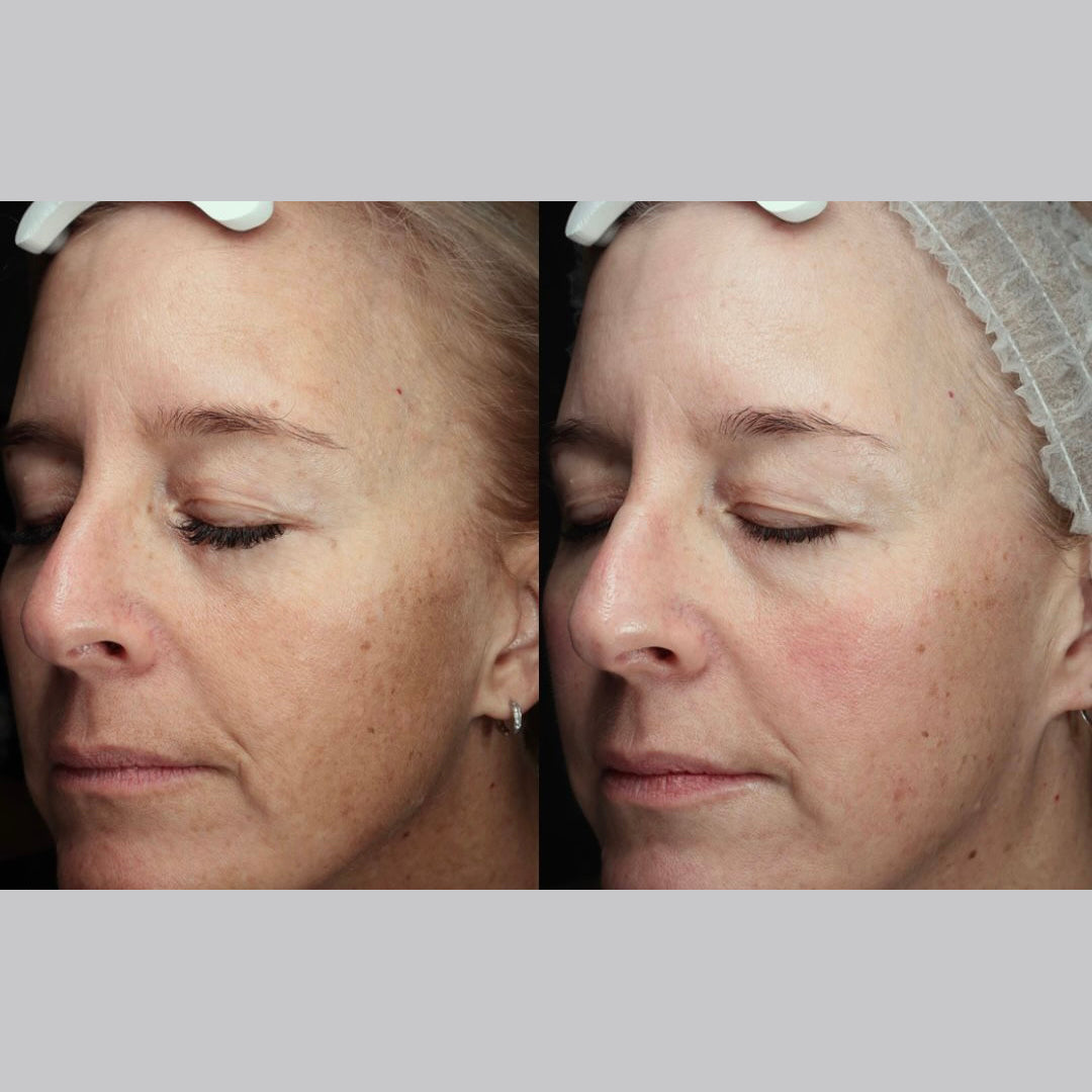 Night Recovery Cream