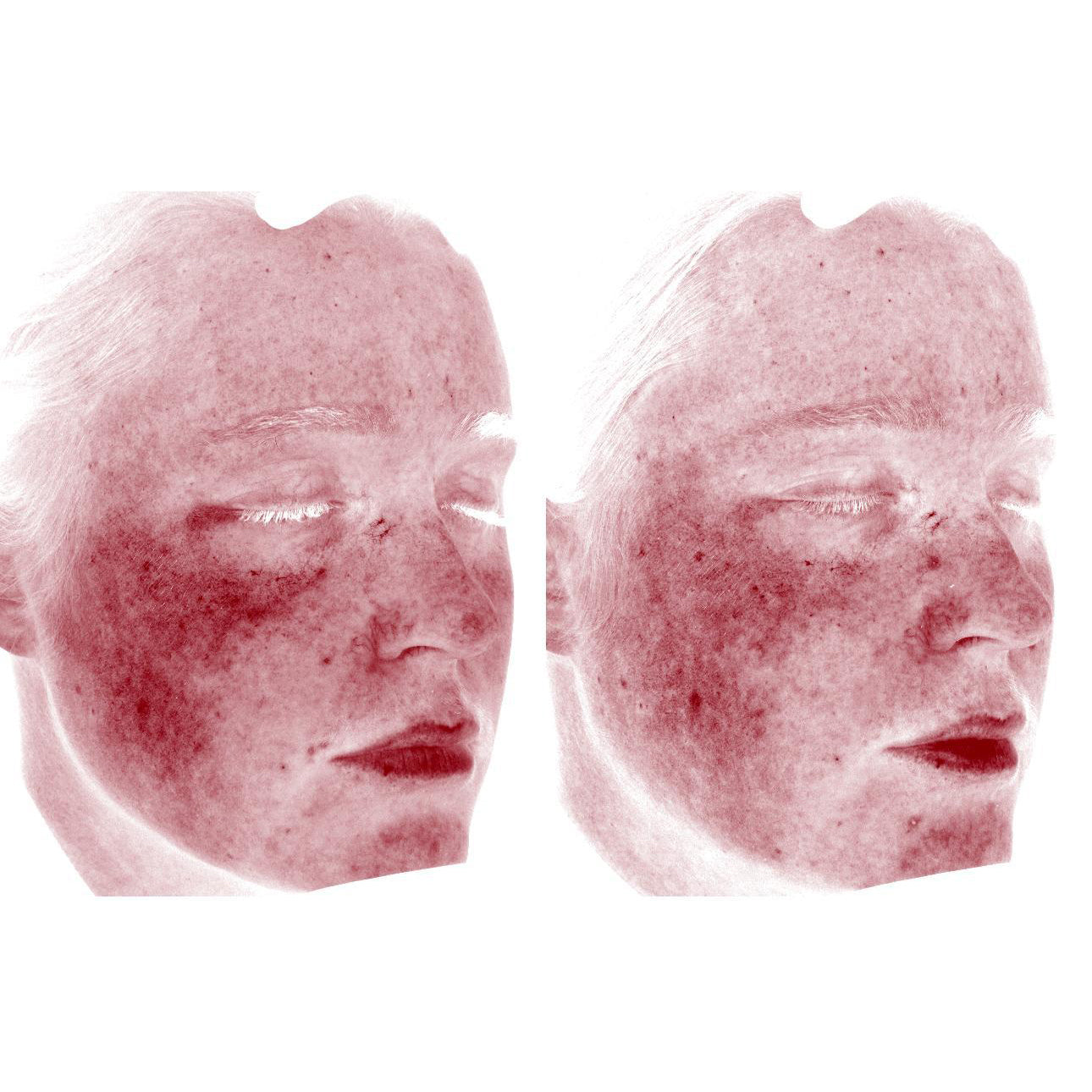 Anti-Redness Power Duo