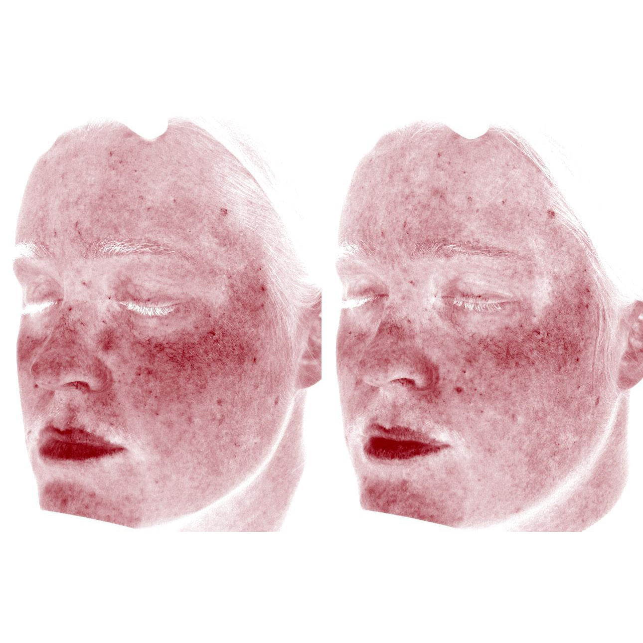 Anti-Redness Power Duo