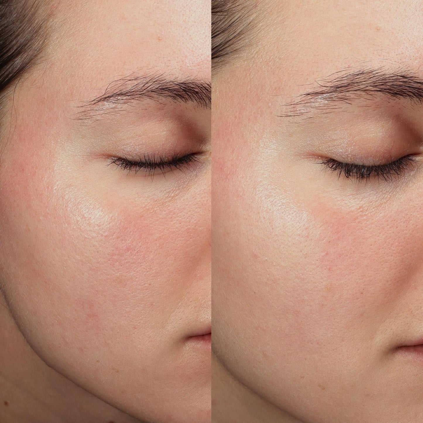 Anti-Blemish Power Duo