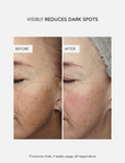Anti-Dark Spot Concentrate