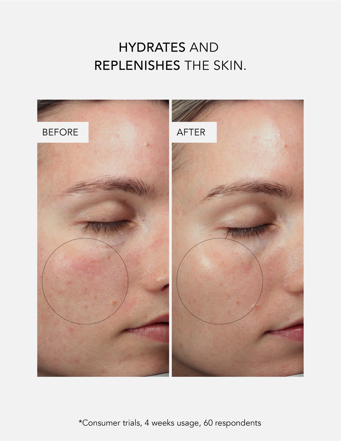 Exosome Barrier Repair Serum