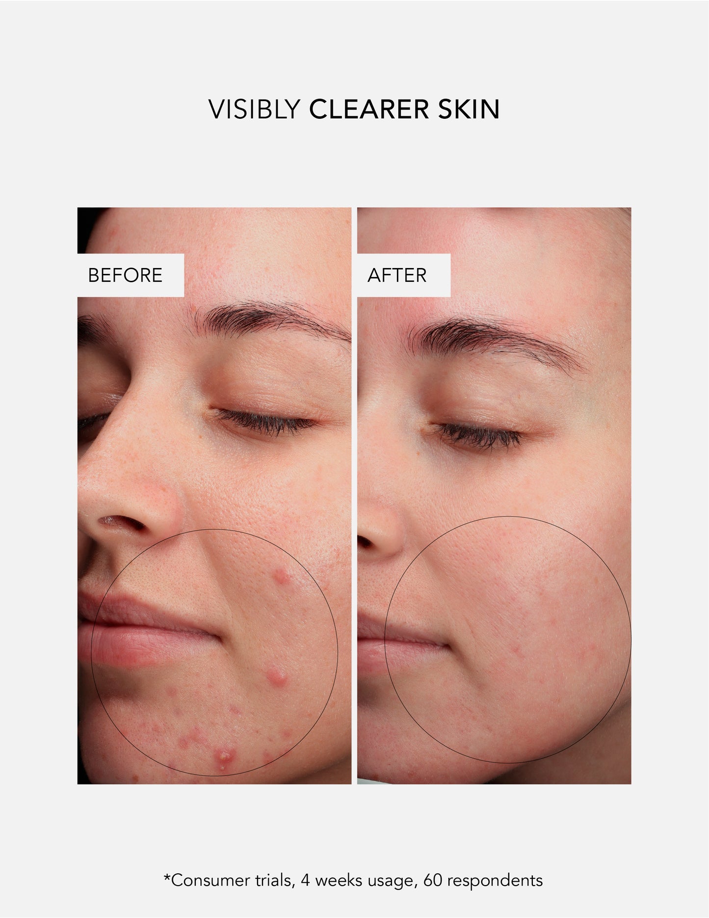 Anti-Blemish Concentrate