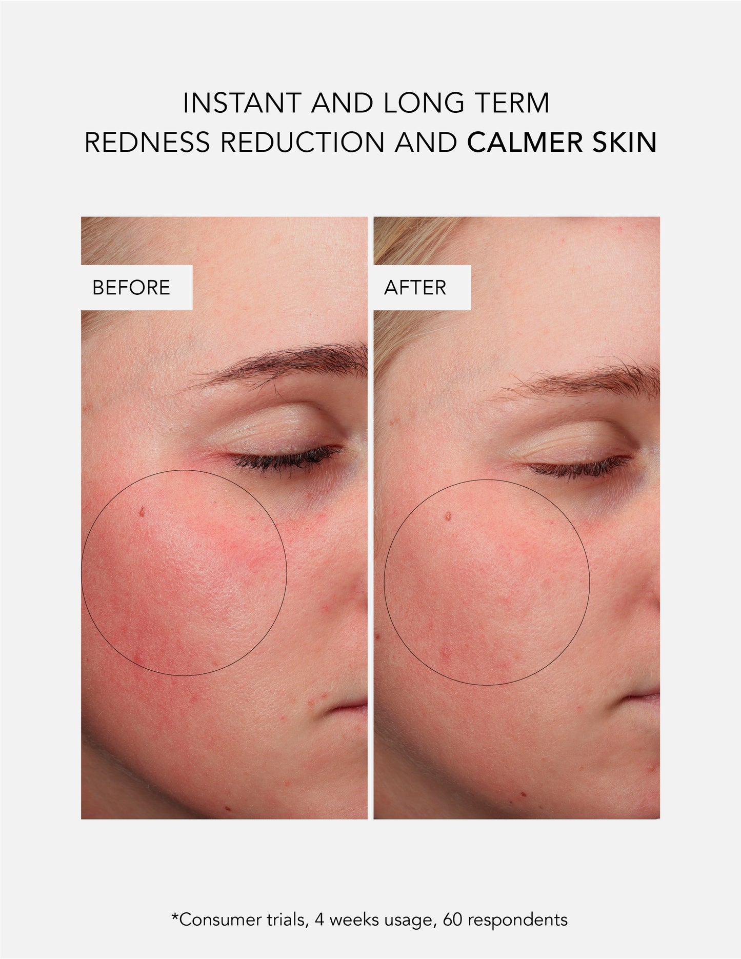 Anti-Redness Concentrate