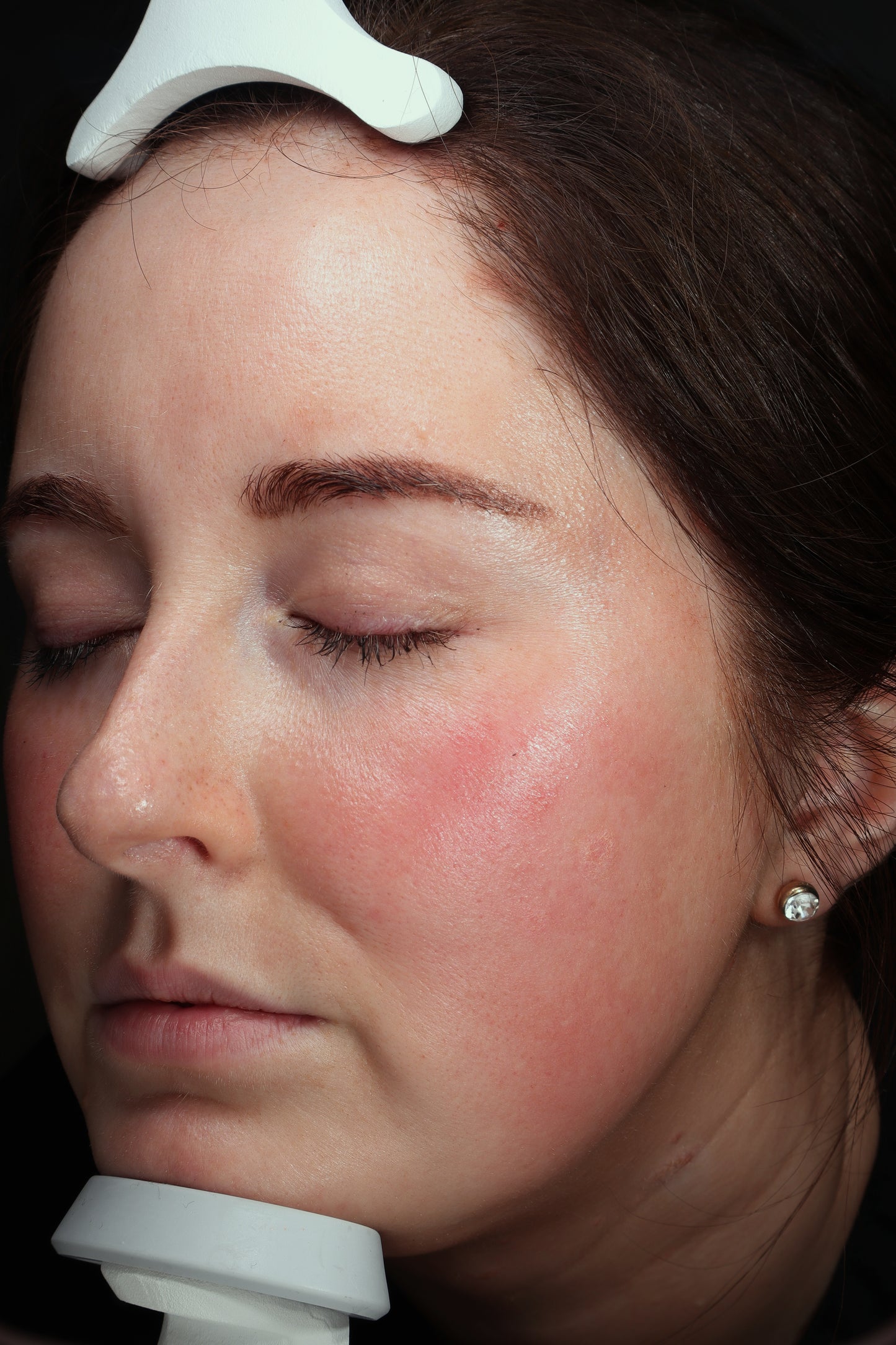 Anti-Redness Concentrate