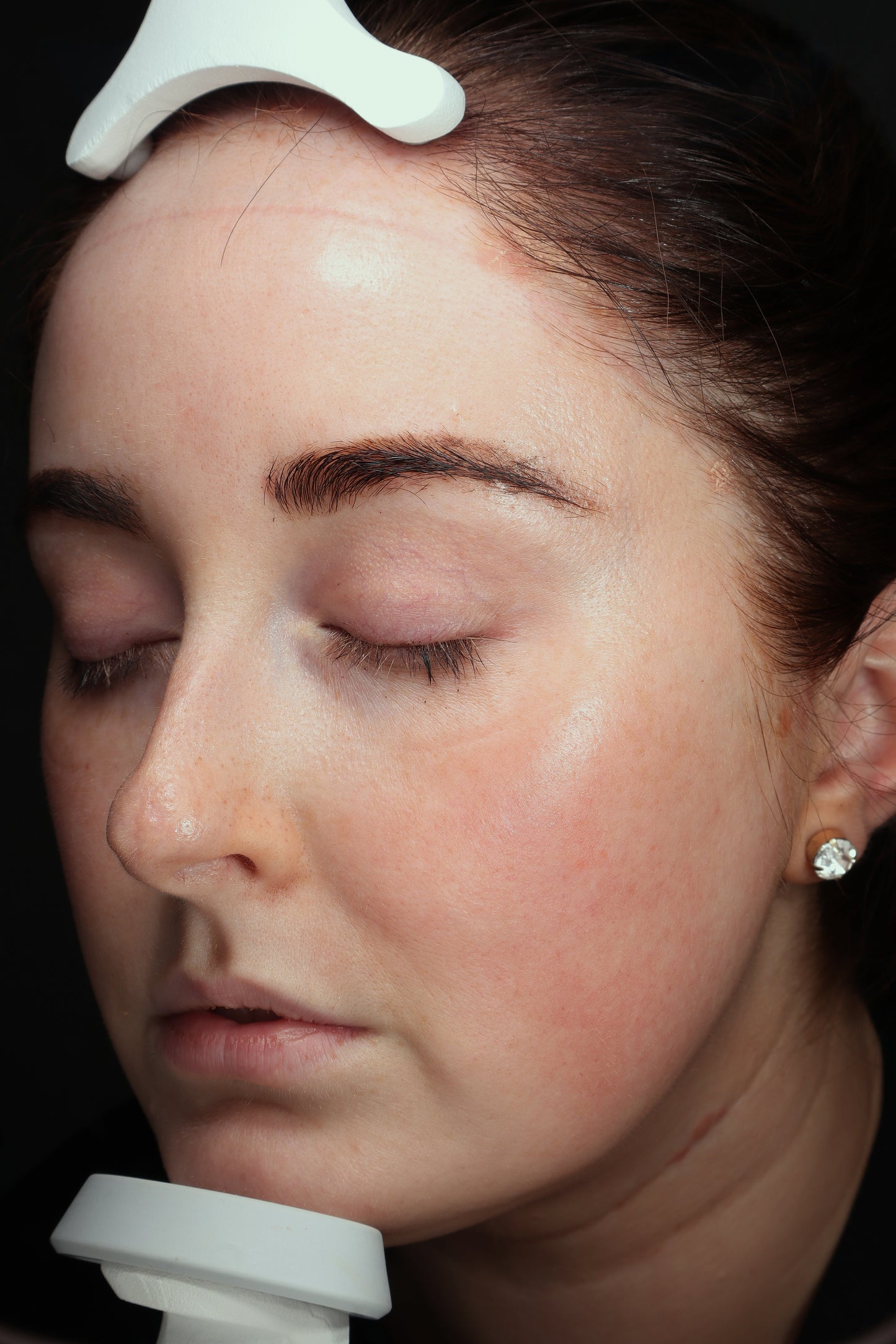 Anti-Redness Concentrate