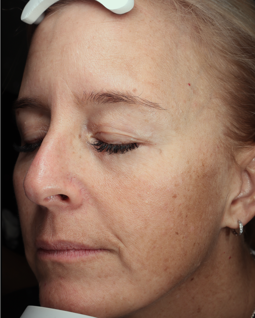 Anti-Wrinkle Power Duo