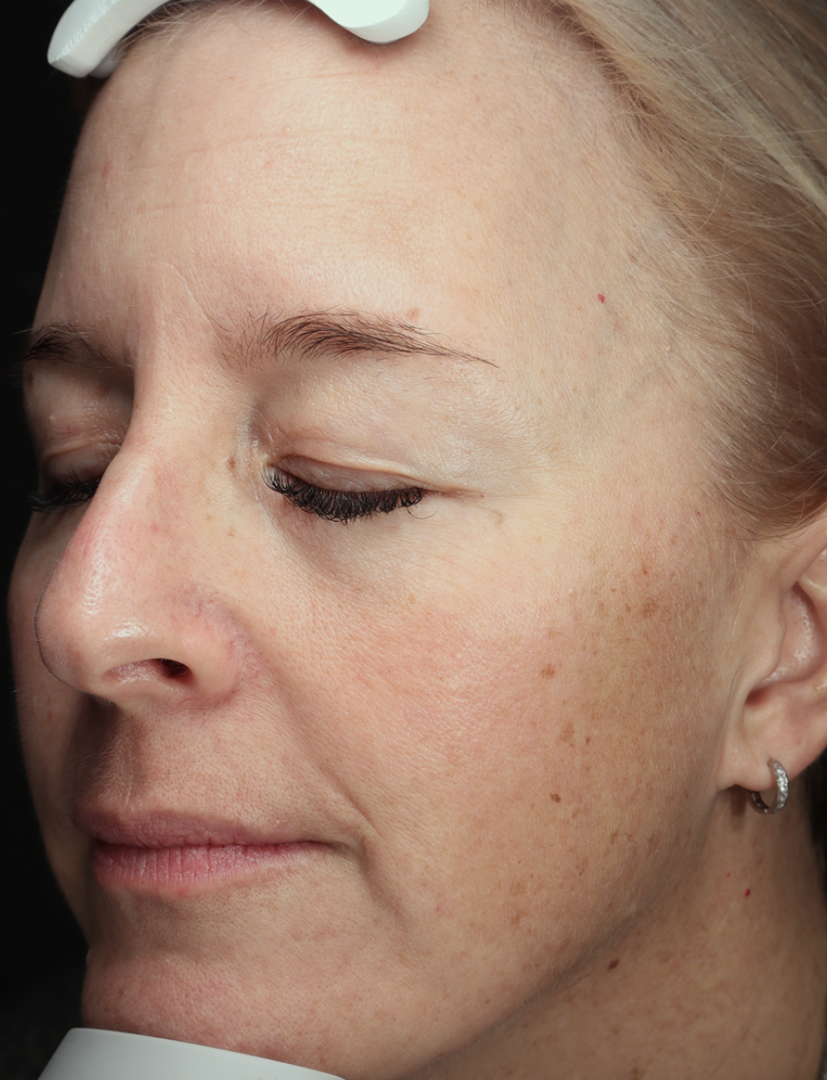 Anti-Wrinkle Power Duo