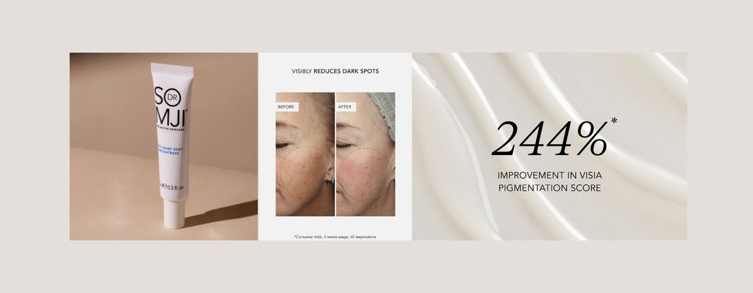 HOW TO TREAT PIGMENTATION, MELASMA AND DULL SKIN - MEET THE NEW DR SOMJI ANTI-DARK SPOT CONCENTRATE
