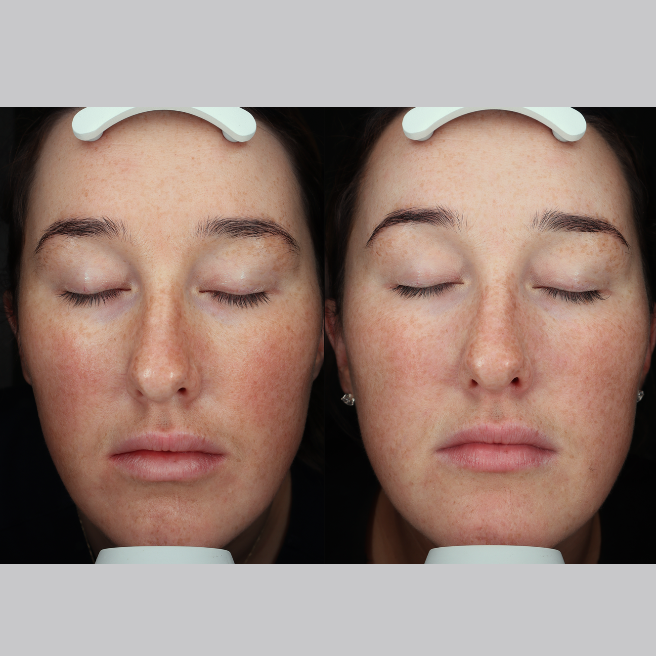 Signature Serum
