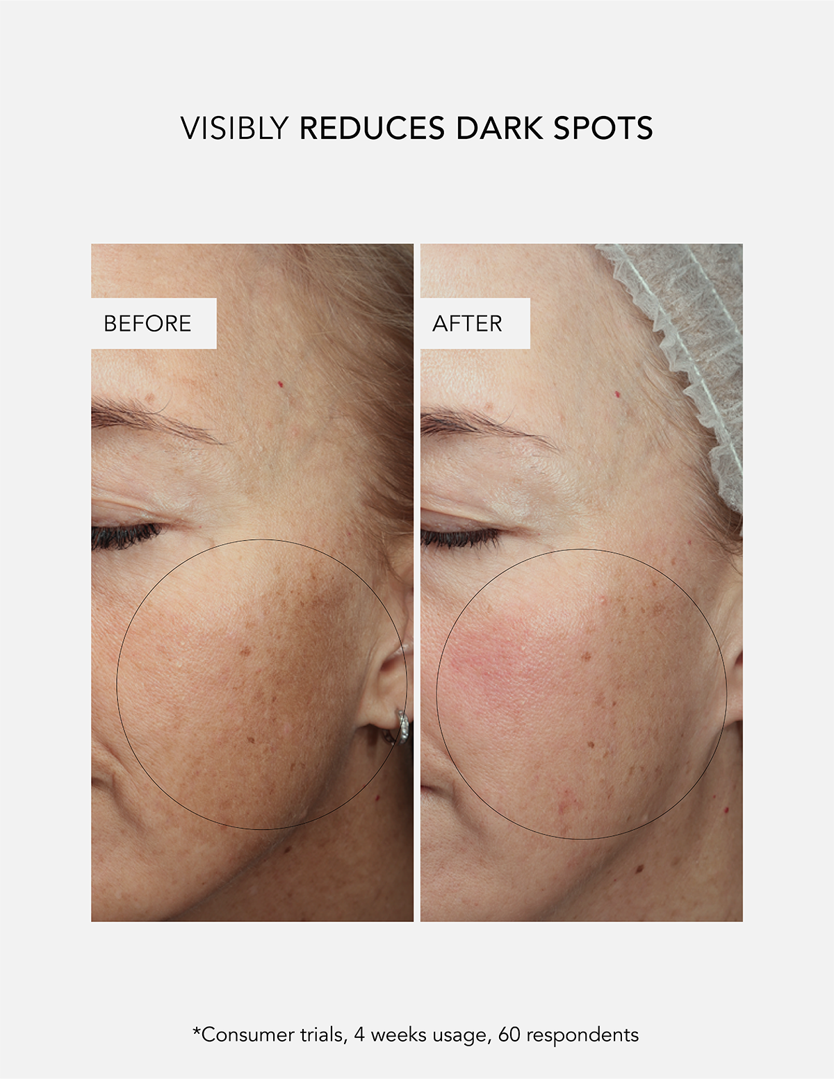 Anti-Dark Spot Concentrate