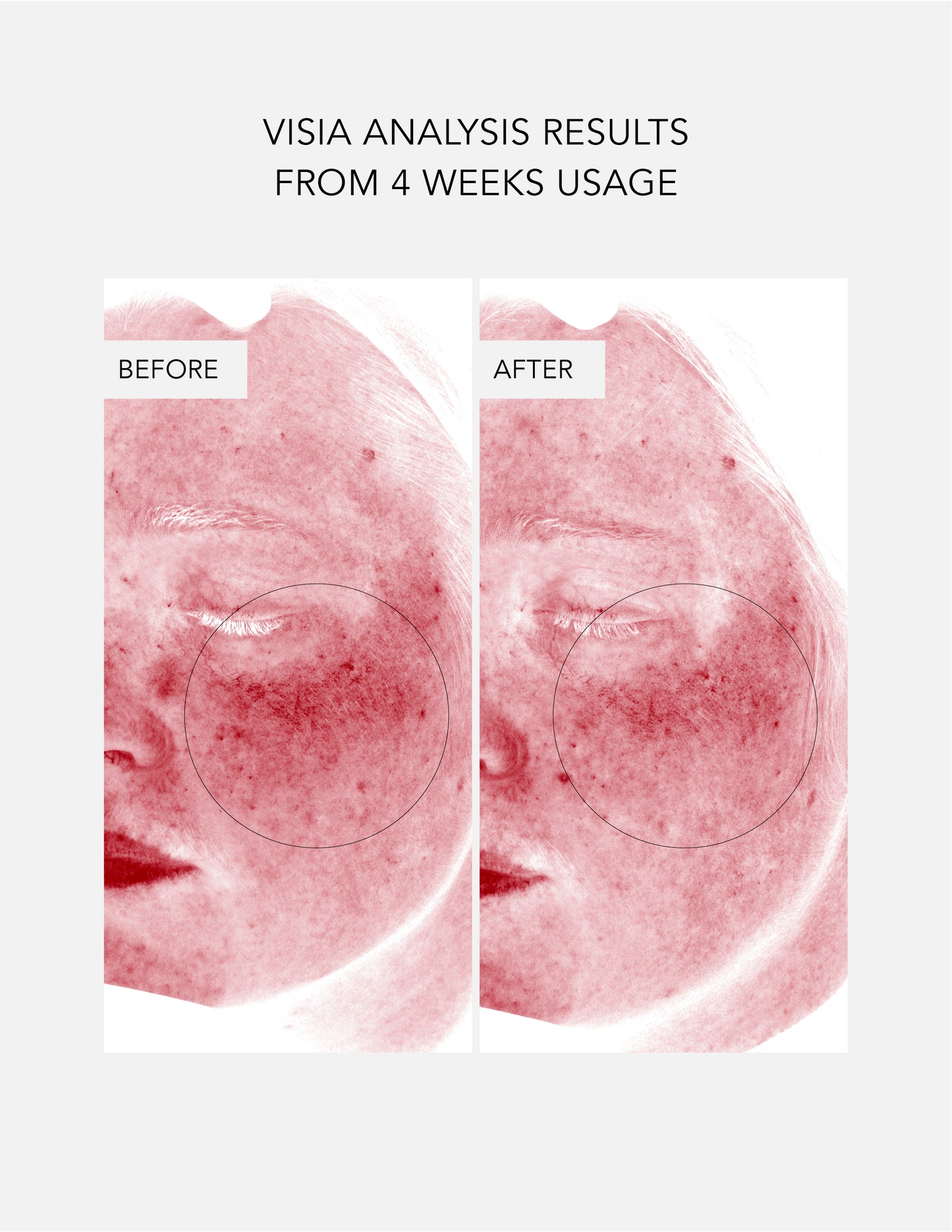 Anti-Redness Routine