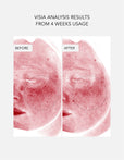 Anti-Redness Power Duo
