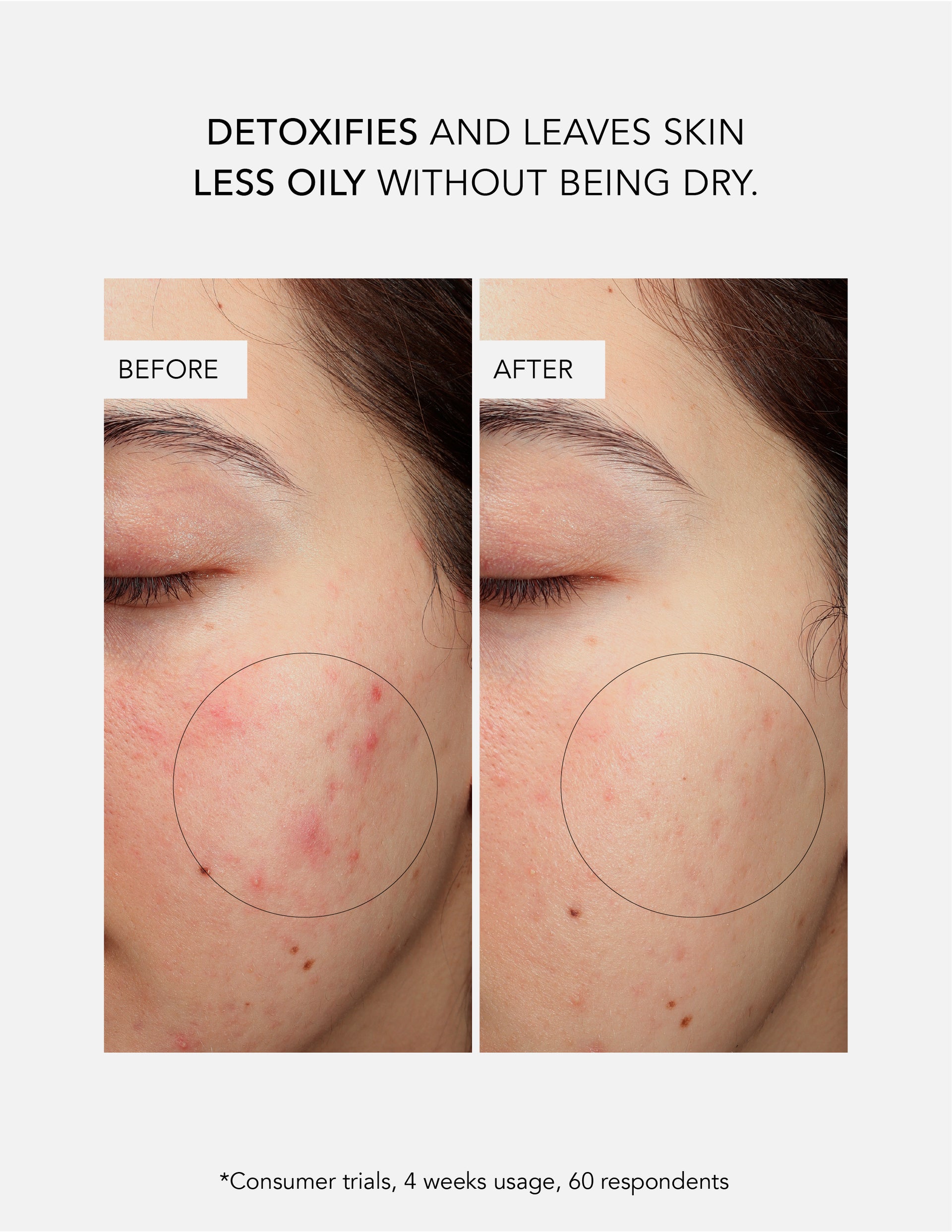 Detoxifying Charcoal Cleanser