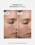 Exosome Barrier Repair Serum