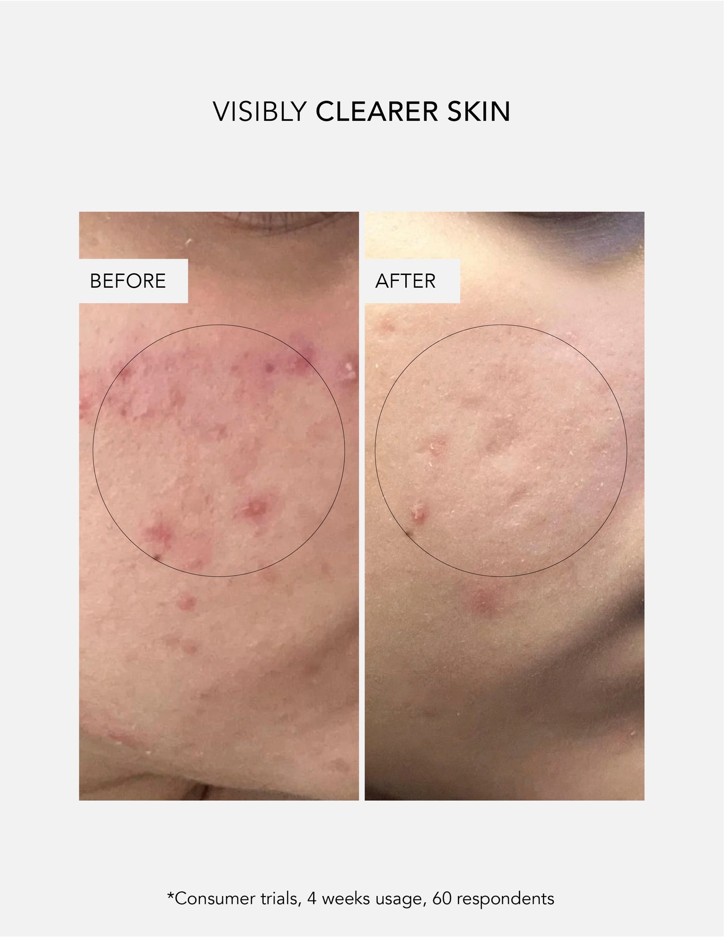 Anti-Blemish Power Duo