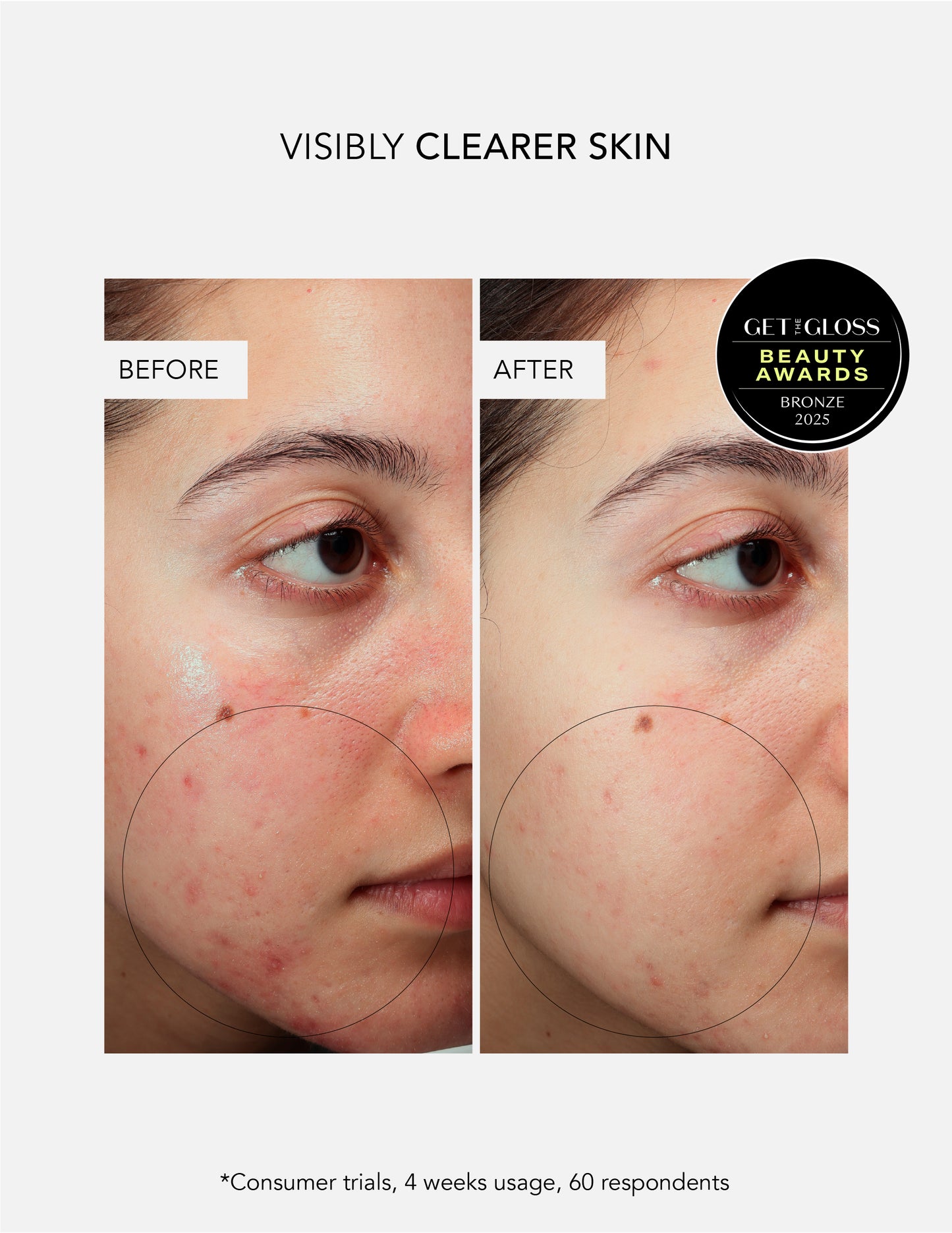 Anti-Blemish Power Duo