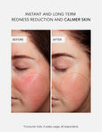 Anti-Redness Power Duo