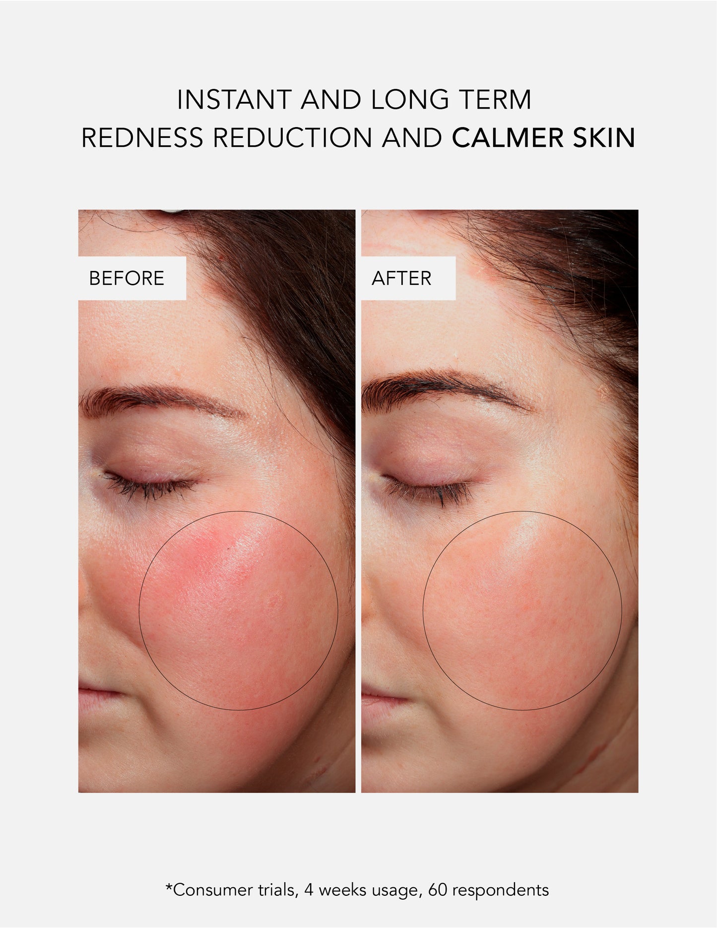 Anti-Redness Routine