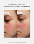 Anti-Redness Routine