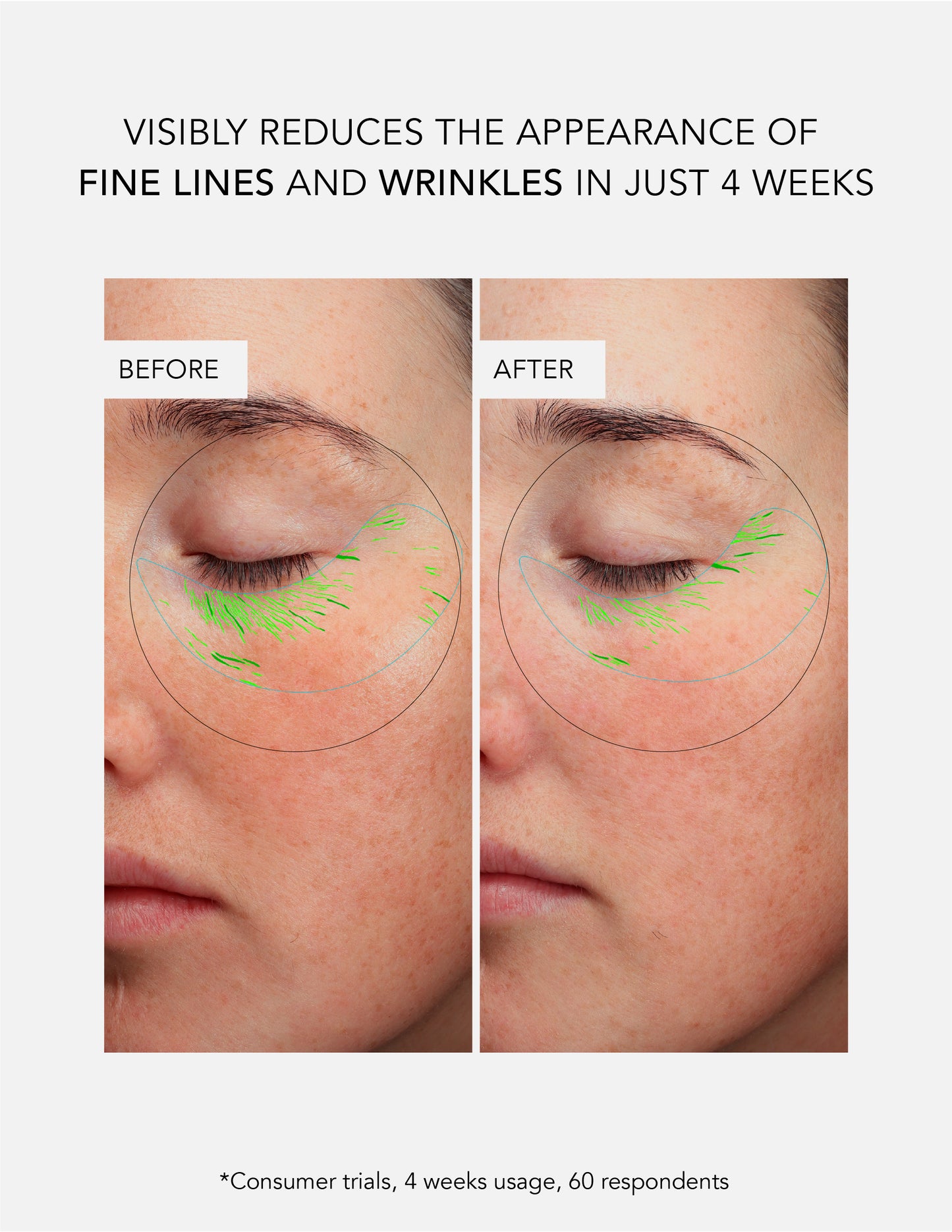 Anti-Wrinkle Concentrate