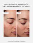 Anti-Wrinkle Power Duo