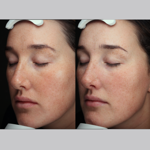 Signature Serum - Image 5