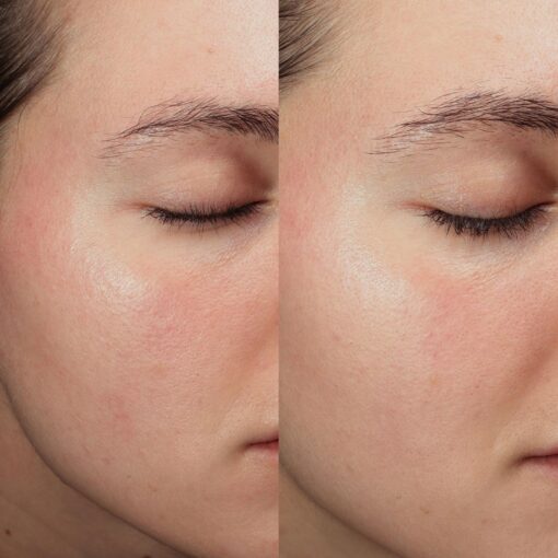Anti-Redness Power Duo - Image 3